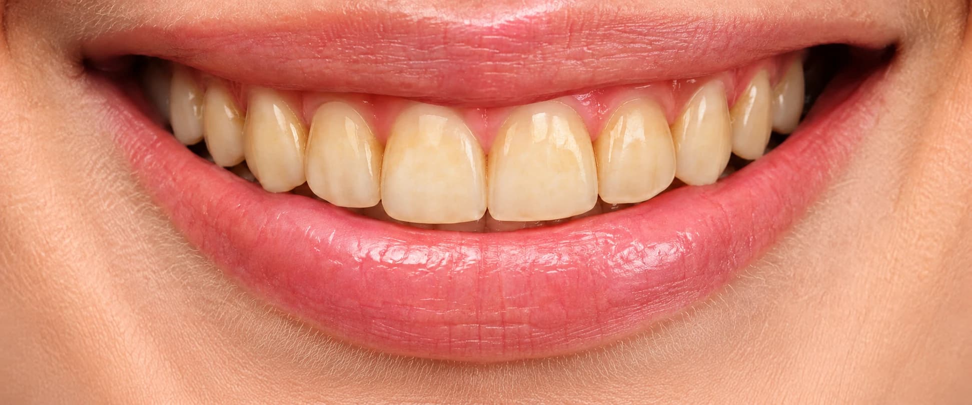 Before treatment